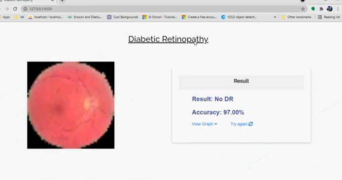 Detection of Diabetic Retinopathy using CNN